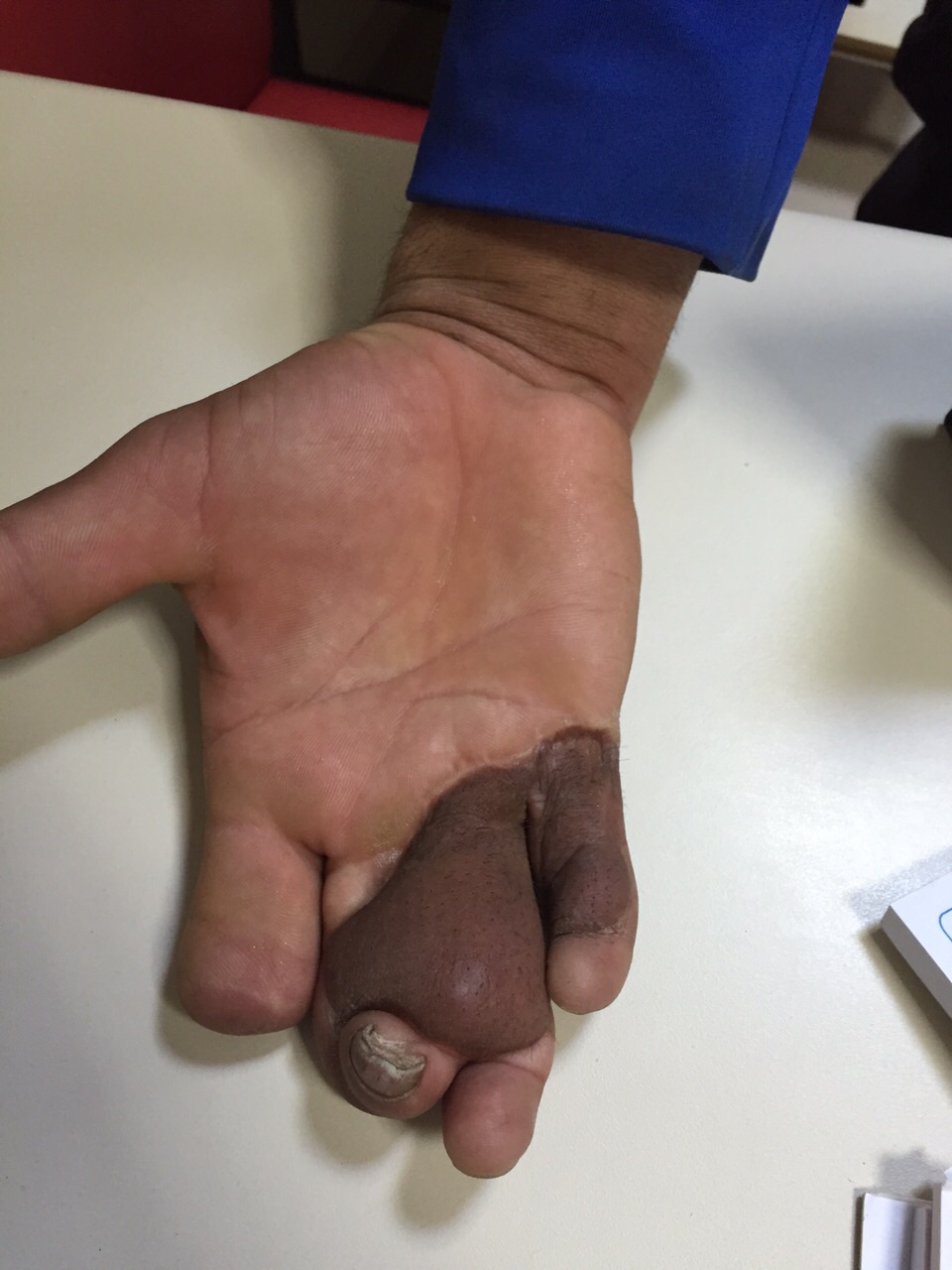 Egeumut’tan Turgutlu’da Bir İlk